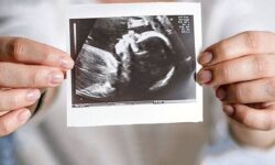 حمایت روانی، مهم‌ترین عامل تداوم بارداری است